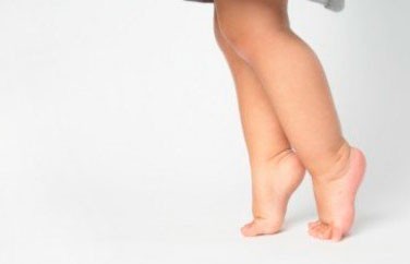 Если малыш передвигается на носочках — это норма или патология